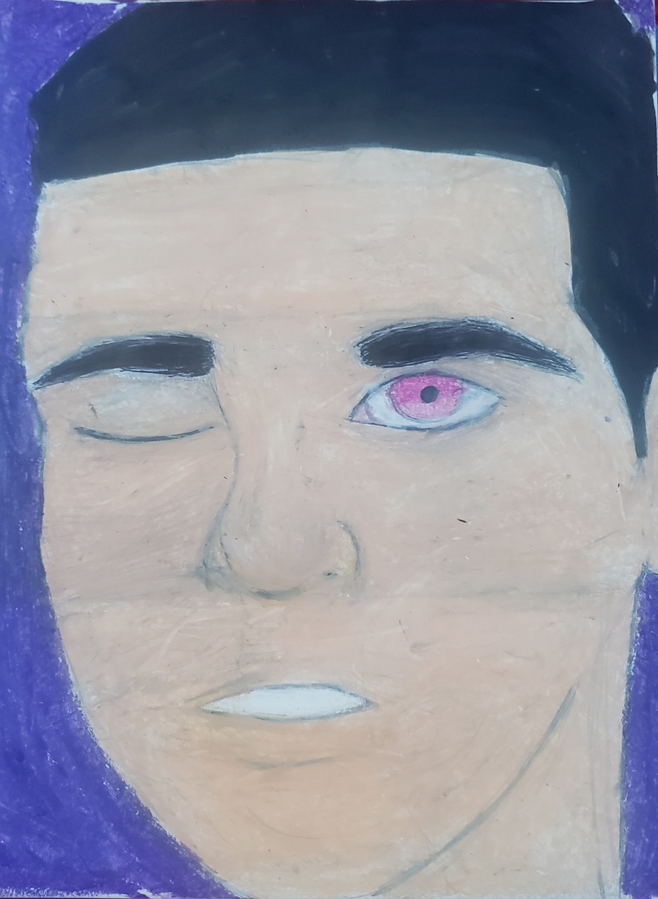 Image of a man looking straight ahead with one pink eye