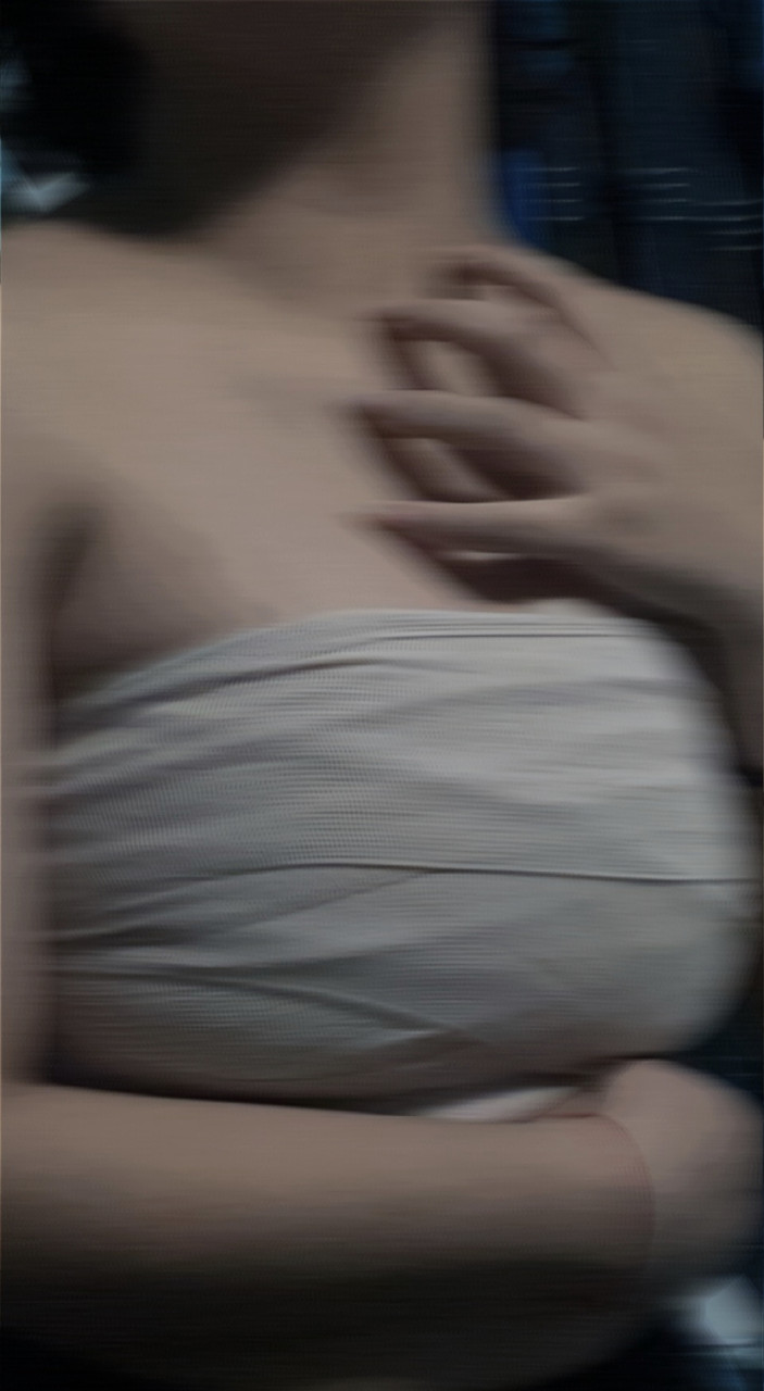 Photograph of a woman scratching her chest