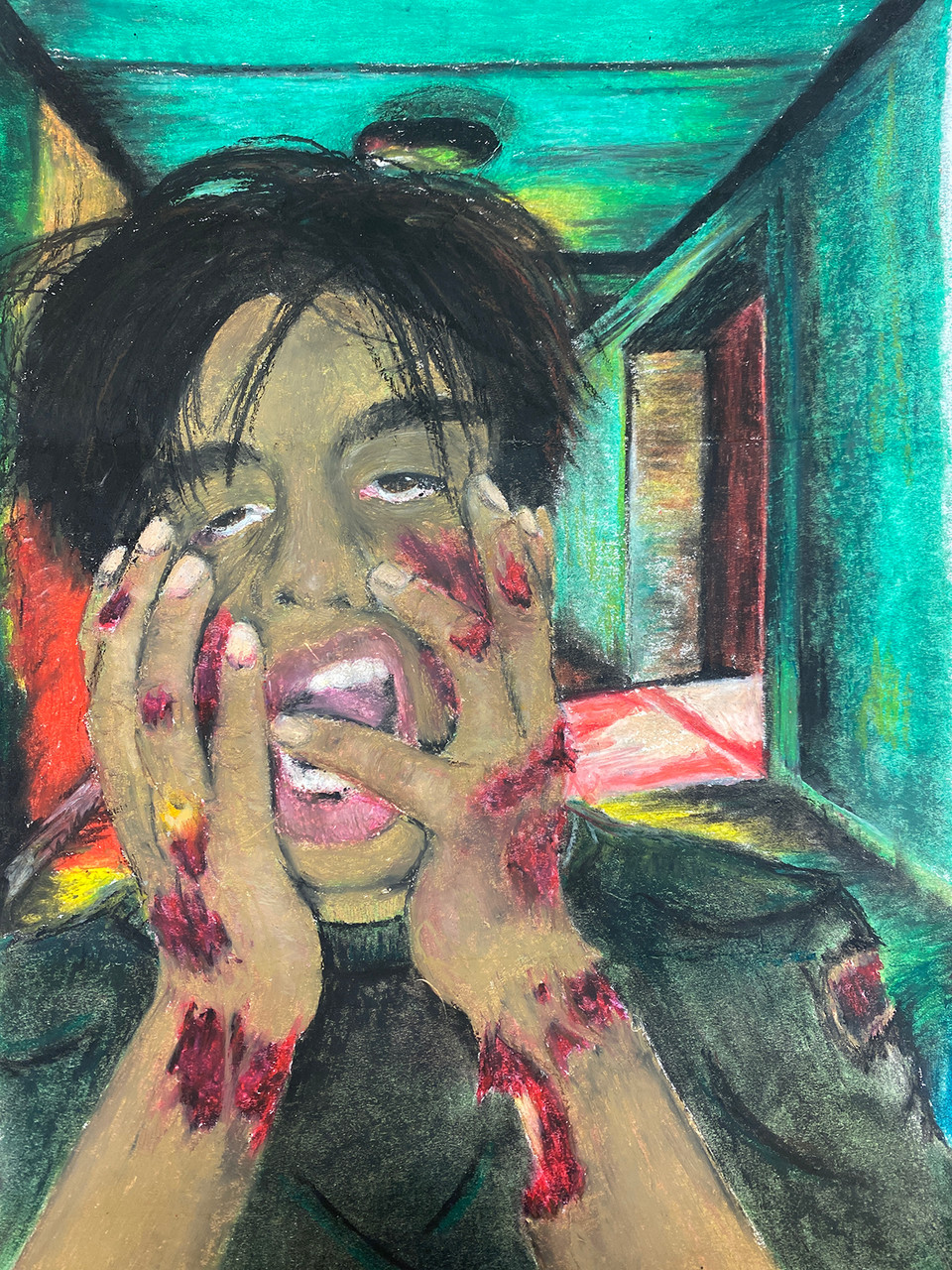 A child holds his face in pain as his skin has lesions.